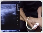 Musculoskeletal Ultrasound Uses