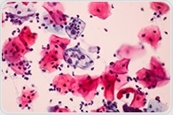 Cervical Cancer Epidemiology