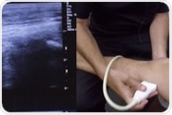 Musculoskeletal Ultrasound Uses