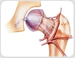 Osteonecrosis Causes, Diagnosis and Management