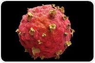 Genomics study reveals five genes linked to treatment resistance in prostate cancer