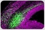 Researchers reveal ebb and flow of gene expression that may awaken neural stem cells