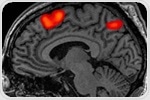 National Multiple Sclerosis Society awards grant for pilot study of social interaction in individuals with MS