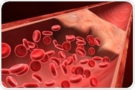 Decline in ischemic stroke among middle-aged adults not as steep as in older people