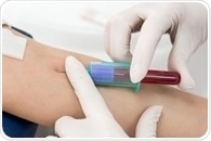 Blood test can assess effectiveness of treatment in patients with skin cancer