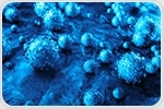 Invasive cervical cancer rates are high among women with HIV in South Africa, Latin America