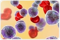 Leukemia and Childhood Infection Hypothesis