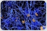 Genetic mutation of APOE gene may provide protection against Alzheimer's disease