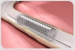 Heart pumps linked to complications in some patients who underwent stent procedures