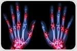 Rheumatoid arthritis linked to other diseases, finds new study