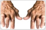 Rheumatoid arthritis: biologics useful in young and old alike