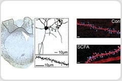 Short chain fatty acid supplementation improves stroke recovery, mice study shows