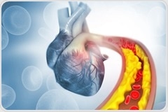 Early cholesterol checks could save your heart