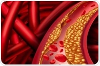 Heart-healthy diet is low in cholesterol, says AHA yet again