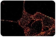 Diabetes-related proteins seen in high-resolution for the first time