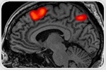 Potential new biomarker for vascular dementia identified