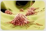 Interleukin-1-beta-induced chronic inflammation promotes lung cancer metastasis