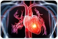 Women and men more likely to have another major cardiovascular event after stroke