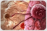 New summary report highlights advances and challenges in small cell lung cancer research