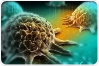 Routine screenings prevent most cervical cancers