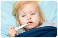 Study: One-third of younger people in São José do Rio Preto lack antibodies against measles