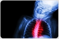 What is Congenital Heart Disease?