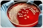 Study shows genetic mutations allow MRSA to develop antibiotic resistance