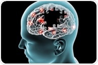 Subtypes in alzheimer's disease may be linked to tau protein modifications