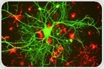 Brain imaging can predict cognitive decline in Alzheimer’s disease