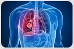 Recent Advancements in Lung Cancer Treatment