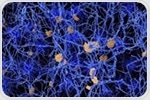 Boosting metabolic resources in the brain could be a way to slow neurodegeneration