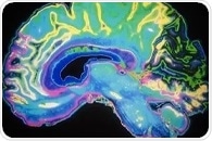 Researchers discover rare genetic disorder that affects the brain, heart and facial features