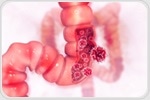 New national screening guidelines on colorectal cancer