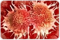 New treatment option offers disease control and extends life in patients with advanced prostate cancer
