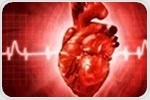 AI-powered tool could accelerate the diagnosis of cardiovascular diseases