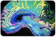 Russian research team presents a novel, supersensitive brain mapping tool
