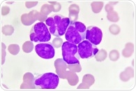 Researchers develop new therapeutic approach for treating acute myeloid leukemia