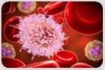 New risk score system to accurately predict leukemia relapse