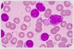 Protein markers in chronic lymphocytic leukemia may help determine patients' prognoses