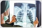 Simple screening method could reduce the occurrence of lung diseases