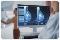 The Biochemistry of Breast Cancer Screening