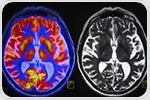Brain research explains why visual information increases attention