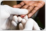 Commonly used blood test may not pick up kidney disease for people in Africa