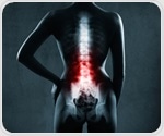 Combination treatment does not slow radiographic spinal progression in radiographic axSpA patients