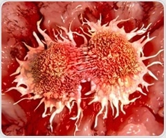 Researchers identify new therapeutic approach against treatment-resistant prostate cancer
