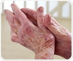 Study finds a novel therapeutic target for prevention and treatment of gout