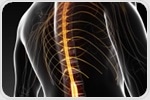 Spinal cord stimulation technology instantly improves arm and hand mobility in stroke patients