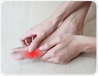Effects of nanoparticles on gouty arthritis in animal models of gout