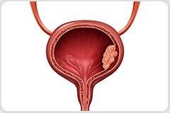 bladder