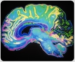 Fibromyalgia causes structural brain changes